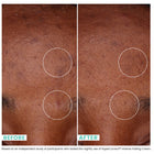 Urban Skin Rx HyperCorrect Intense Fading Cream Skin Fades