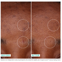 Urban Skin Rx HyperCorrect Intense Fading Cream Skin Fades
